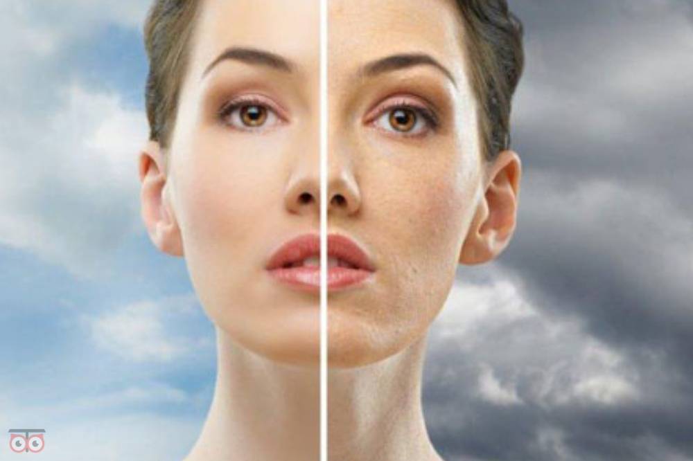 تخفیف ویژه پاکسازی پوست تخفیف ویژه پاکسازی پوست