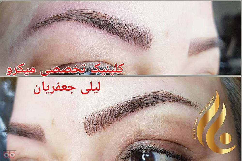 تخفیف ویژه خدمات میکروپیگمنتیشن تخفیف ویژه خدمات میکروپیگمنتیشن