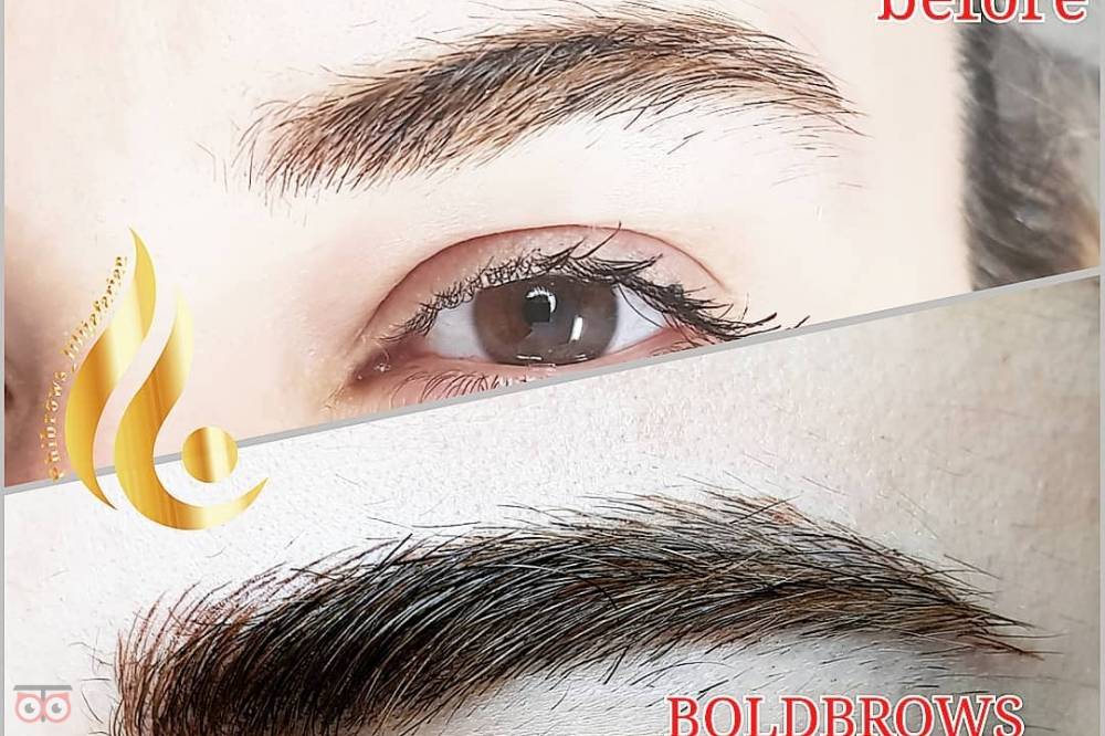 تخفیف ویژه خدمات میکروپیگمنتیشن تخفیف ویژه خدمات میکروپیگمنتیشن