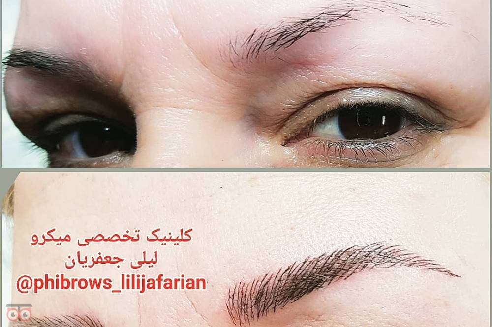 تخفیف ویژه خدمات میکروپیگمنتیشن تخفیف ویژه خدمات میکروپیگمنتیشن