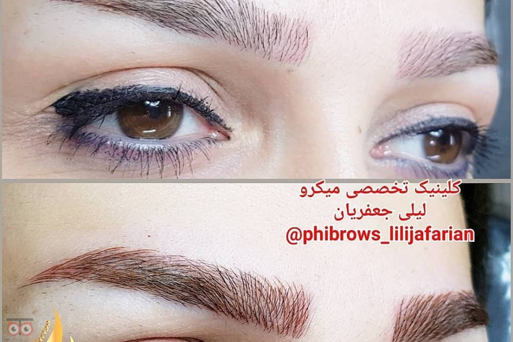 تخفیف ویژه خدمات میکروپیگمنتیشن تخفیف ویژه خدمات میکروپیگمنتیشن