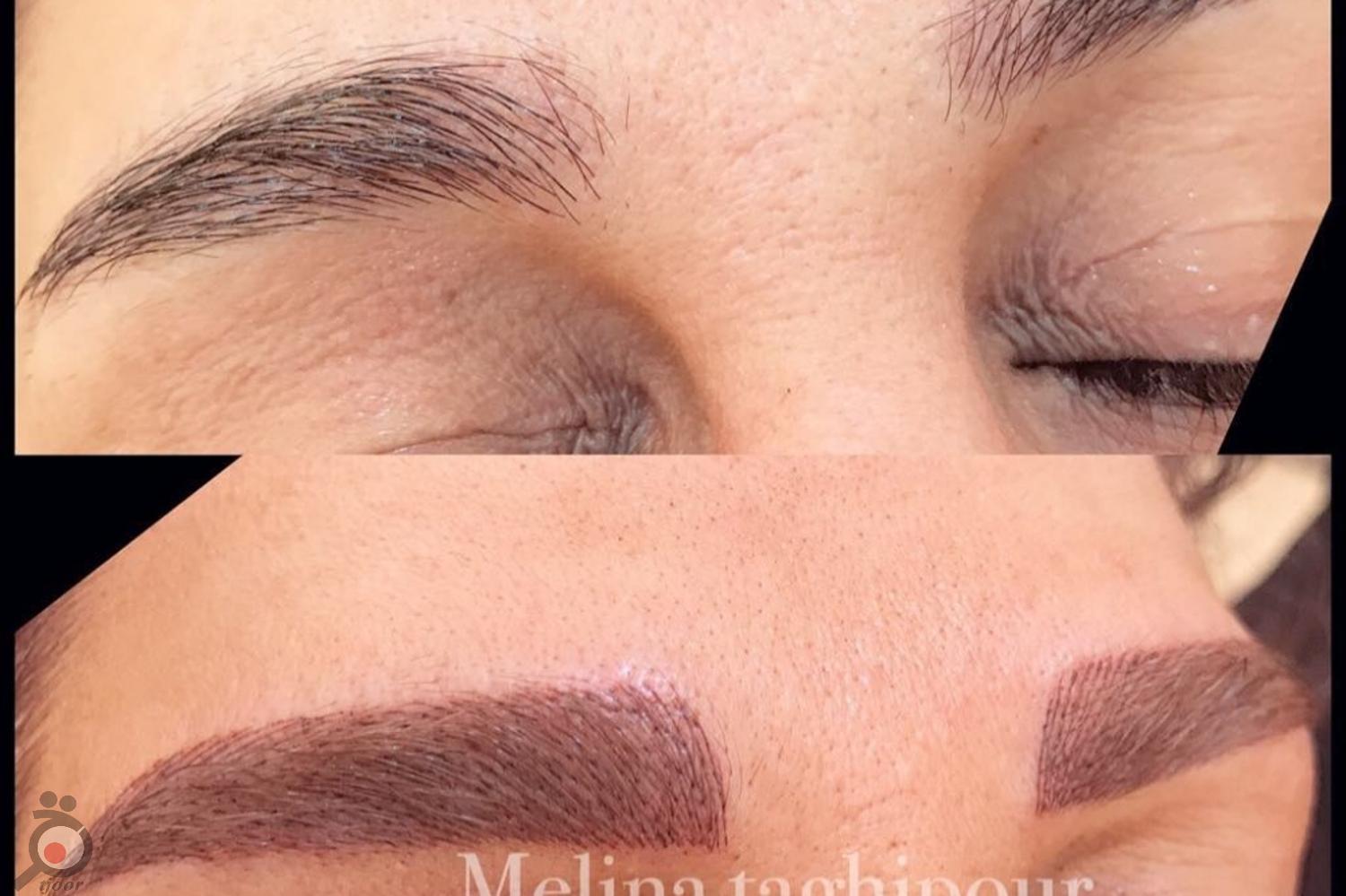 تخفیف ویژه میکروپیگمنتیشن ابرو تخفیف ویژه میکروپیگمنتیشن ابرو