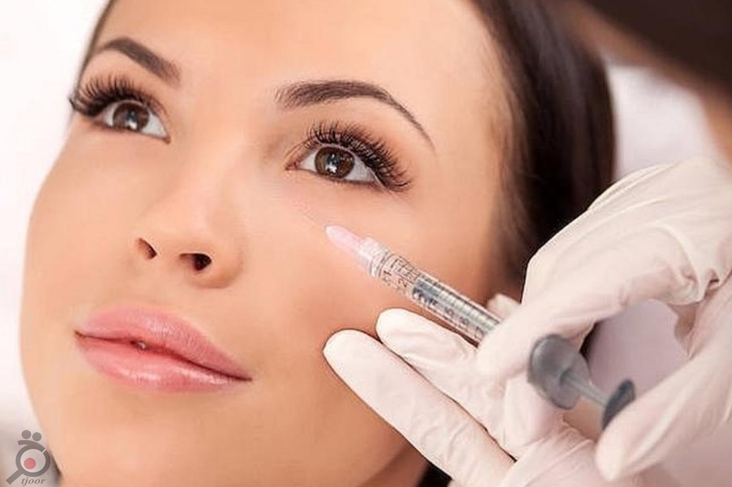 تخفیف ویژه بوتاکس تخفیف ویژه بوتاکس