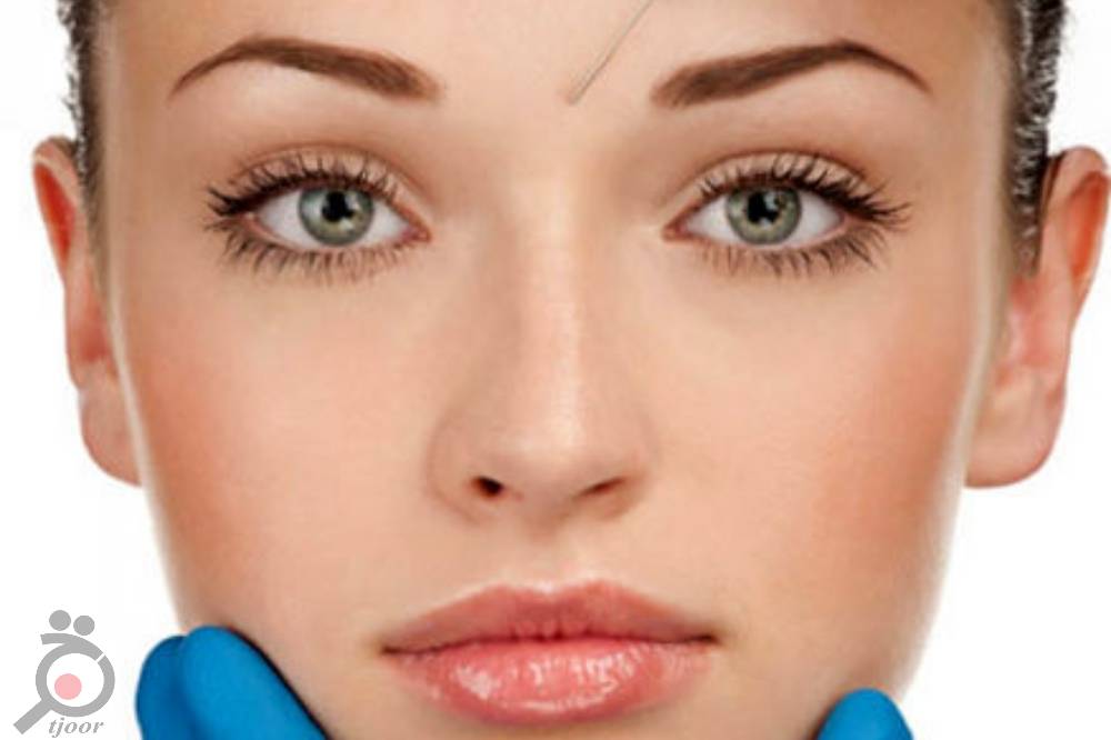 تخفیف زمستانی خدمات زیبایی و درمانی کلینیک ستاره فرهنگ تخفیف زمستانی خدمات زیبایی و درمانی کلینیک ستاره فرهنگ