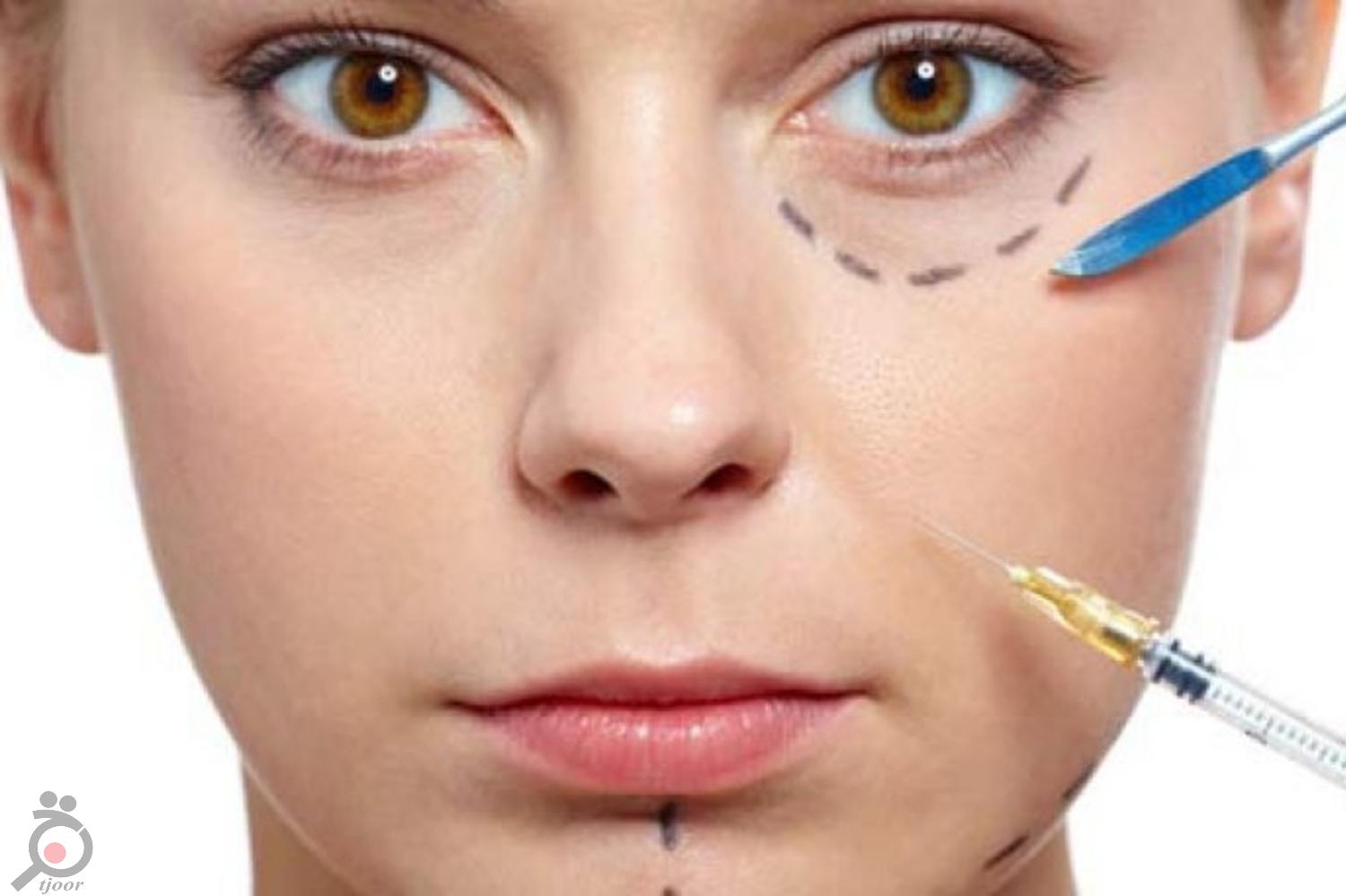 تخفیف ویژه تزریق فیلر تخفیف ویژه تزریق فیلر