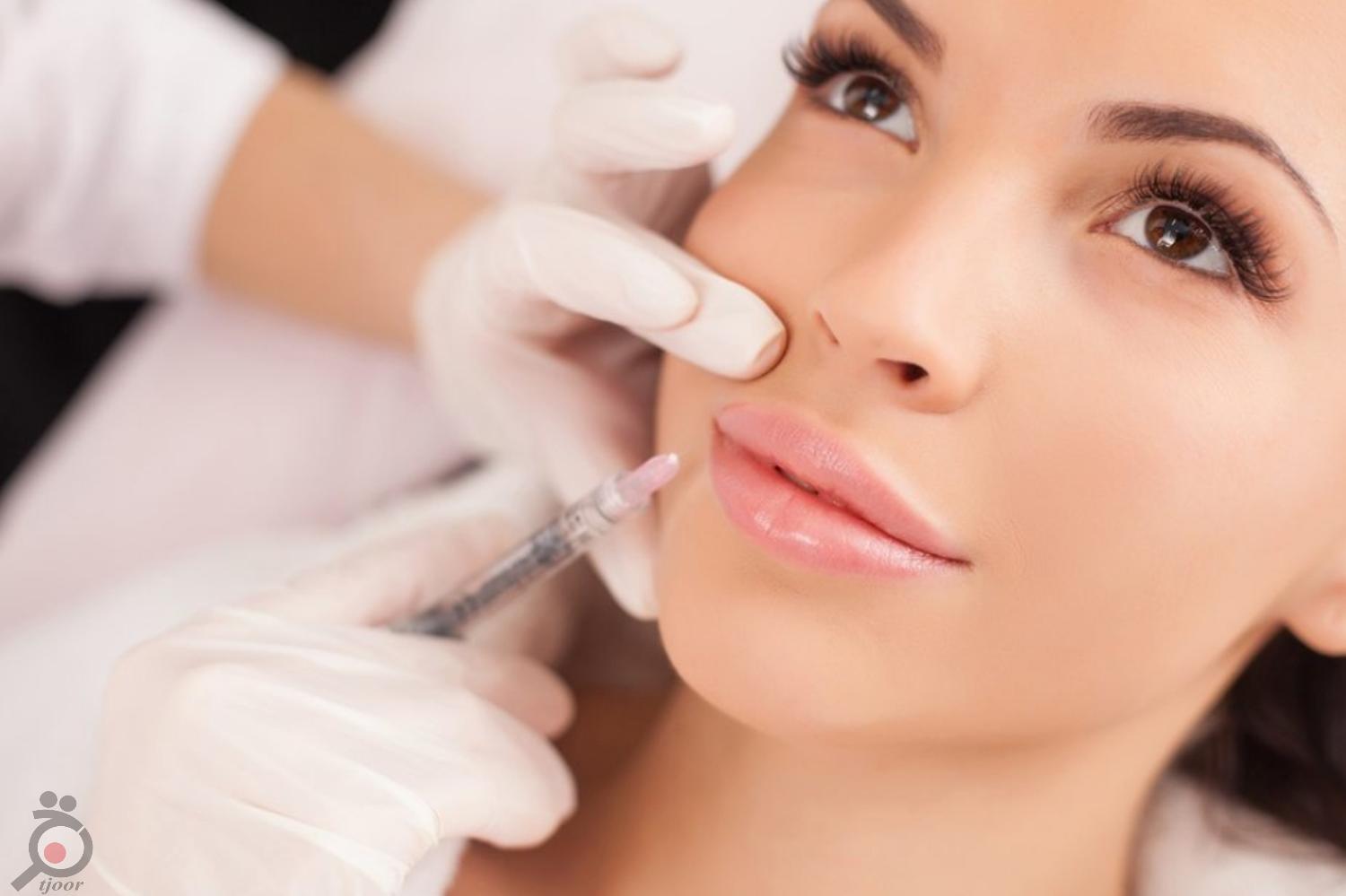 تخفیف ویژه ژل و بوتاکس تخفیف ویژه ژل و بوتاکس