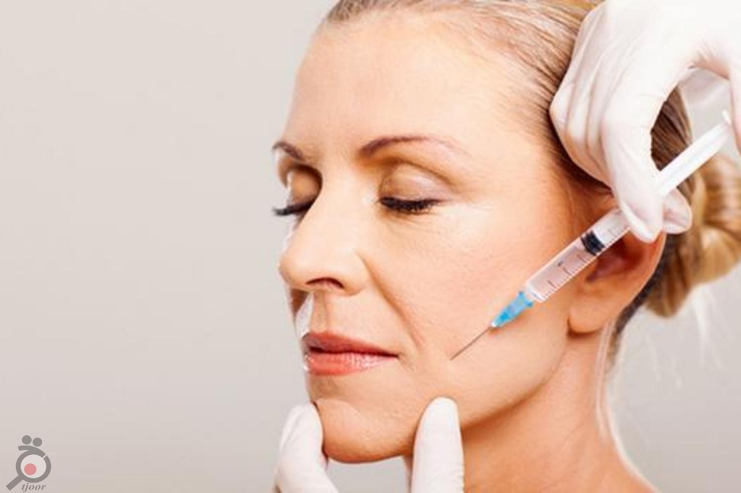 تخفیف ویژه ژل و بوتاکس تخفیف ویژه ژل و بوتاکس