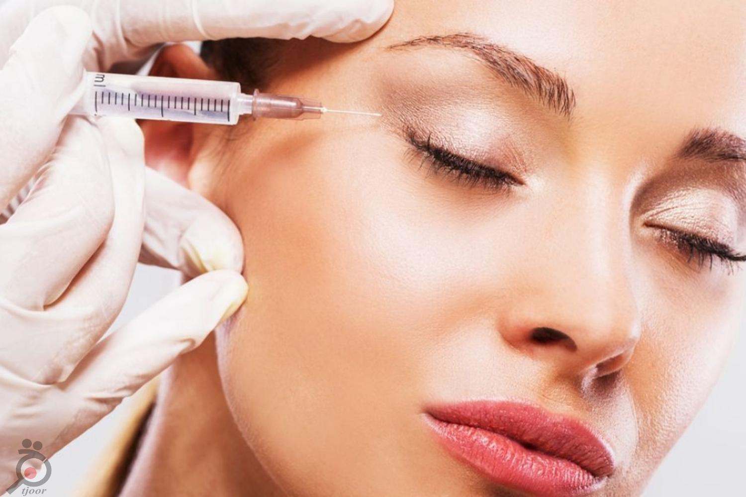 تخفیف ویژه ژل و بوتاکس تخفیف ویژه ژل و بوتاکس