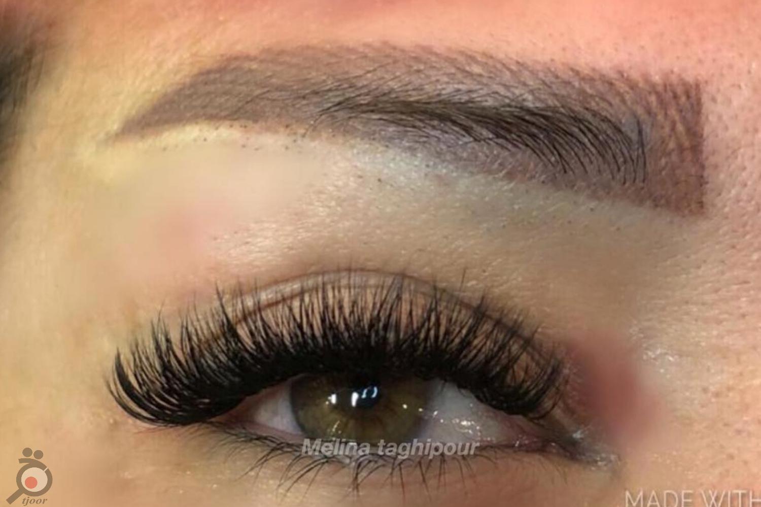 تخفیف ویژه انجام میکروپیگمنتیشن تخفیف ویژه انجام میکروپیگمنتیشن