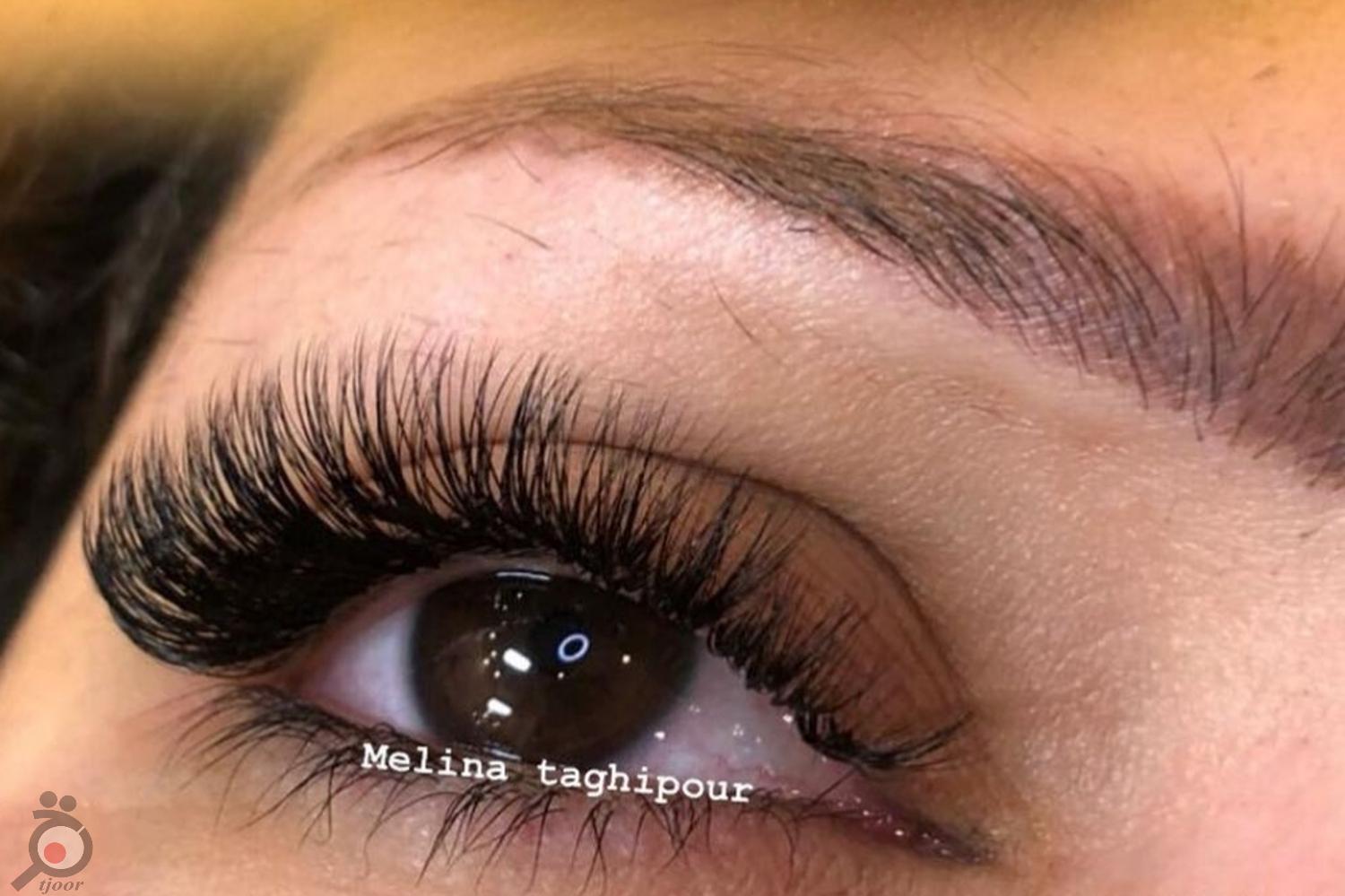 تخفیف ویژه انجام میکروپیگمنتیشن تخفیف ویژه انجام میکروپیگمنتیشن