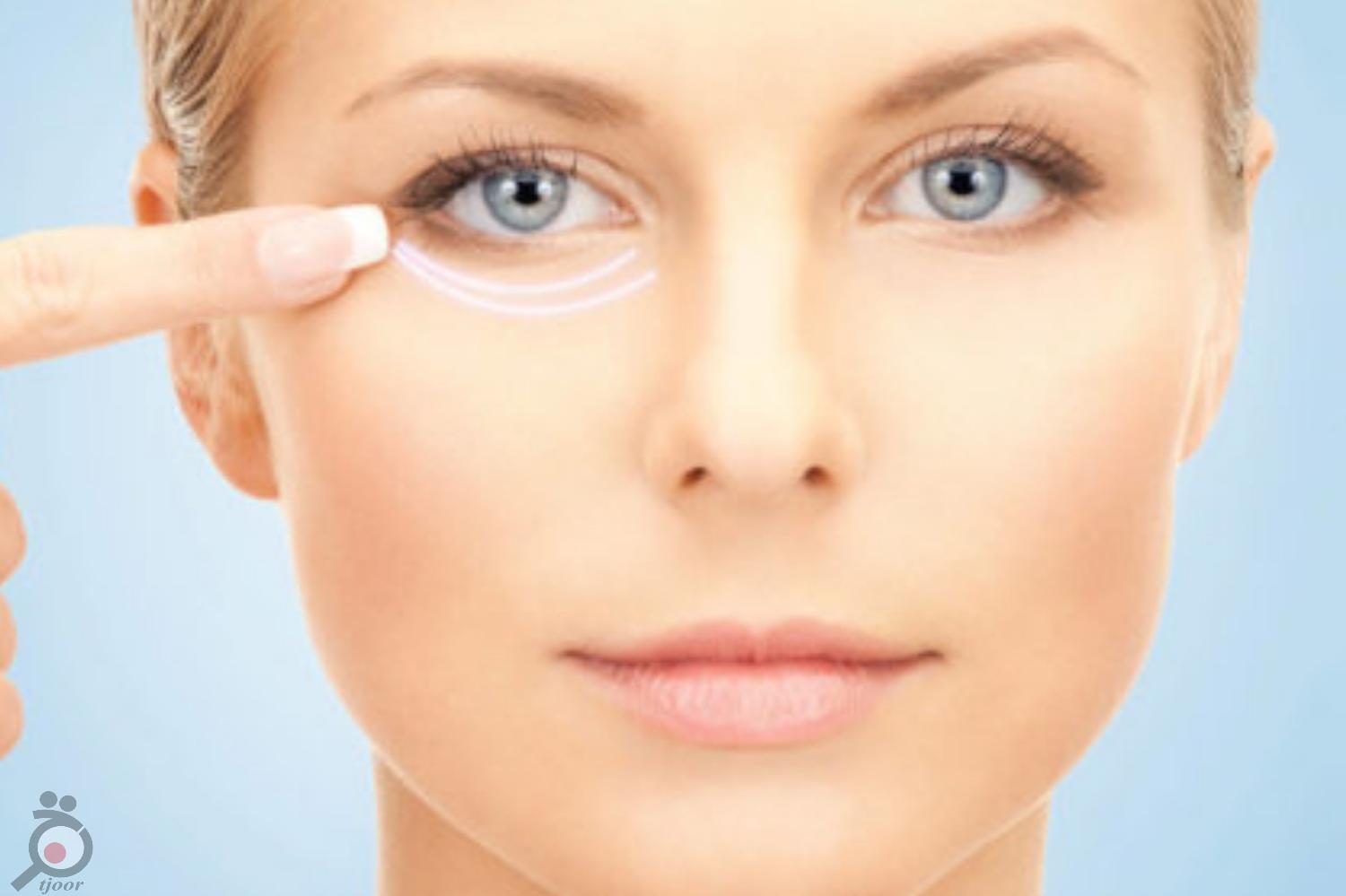 پکیح لاغری مخصوص زمستان پکیح لاغری مخصوص زمستان