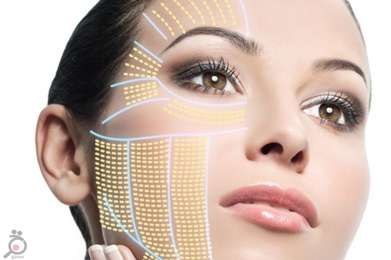 تخفیف ویژه هایفوتراپی و جوانسازی تخفیف ویژه هایفوتراپی و جوانسازی