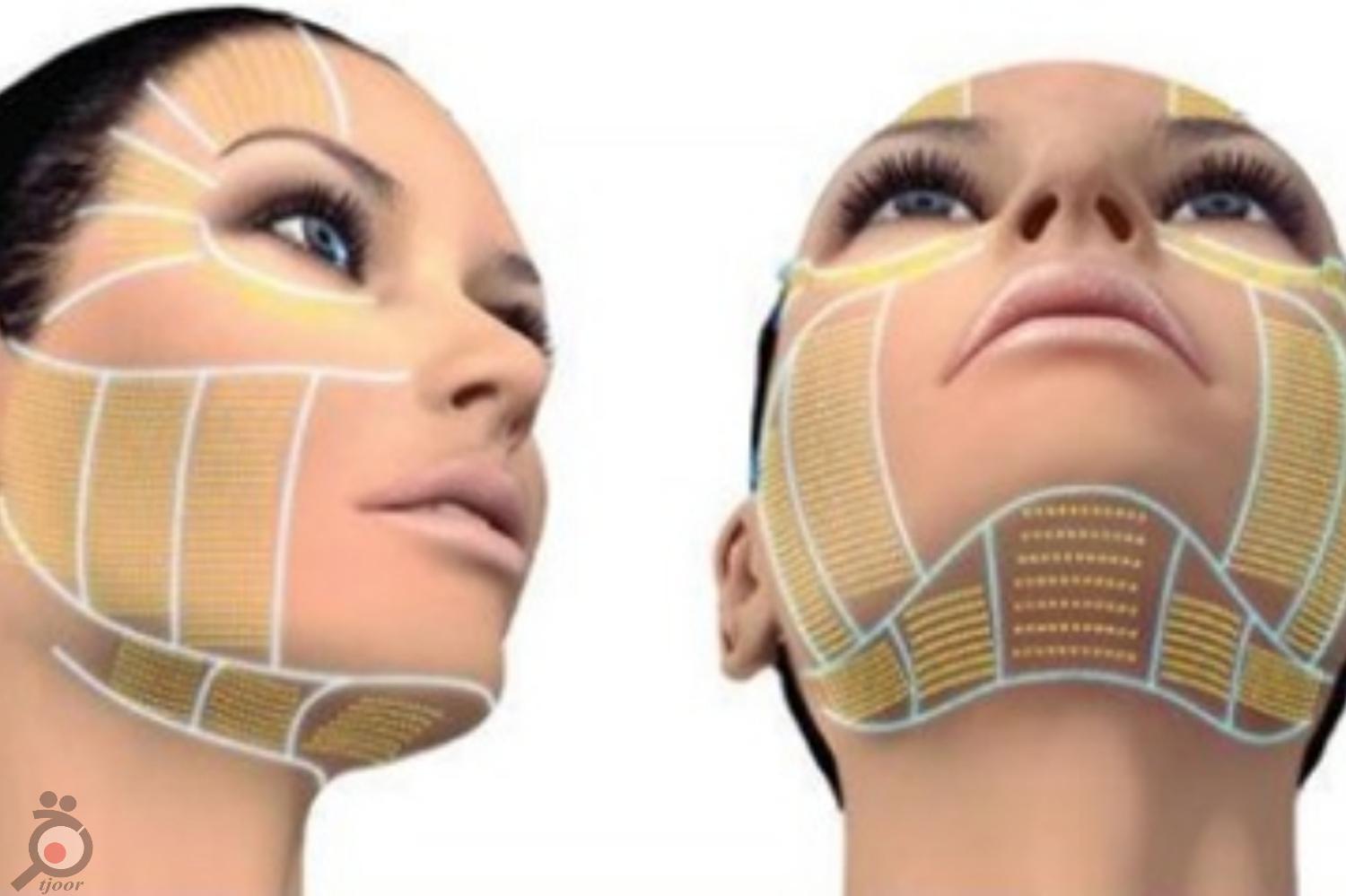 تخفیف ویژه هایفوتراپی و جوانسازی تخفیف ویژه هایفوتراپی و جوانسازی