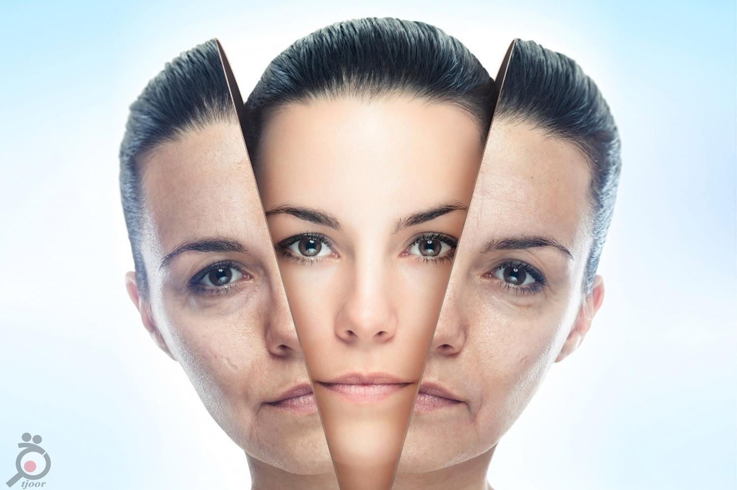 تخفیف ویژه هایفوتراپی و جوانسازی تخفیف ویژه هایفوتراپی و جوانسازی