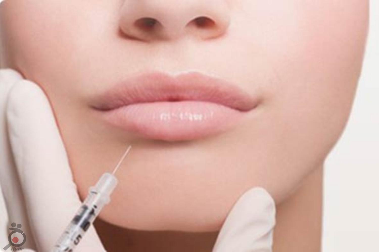 تخفیف تزریق ژل آلمانی تخفیف تزریق ژل آلمانی