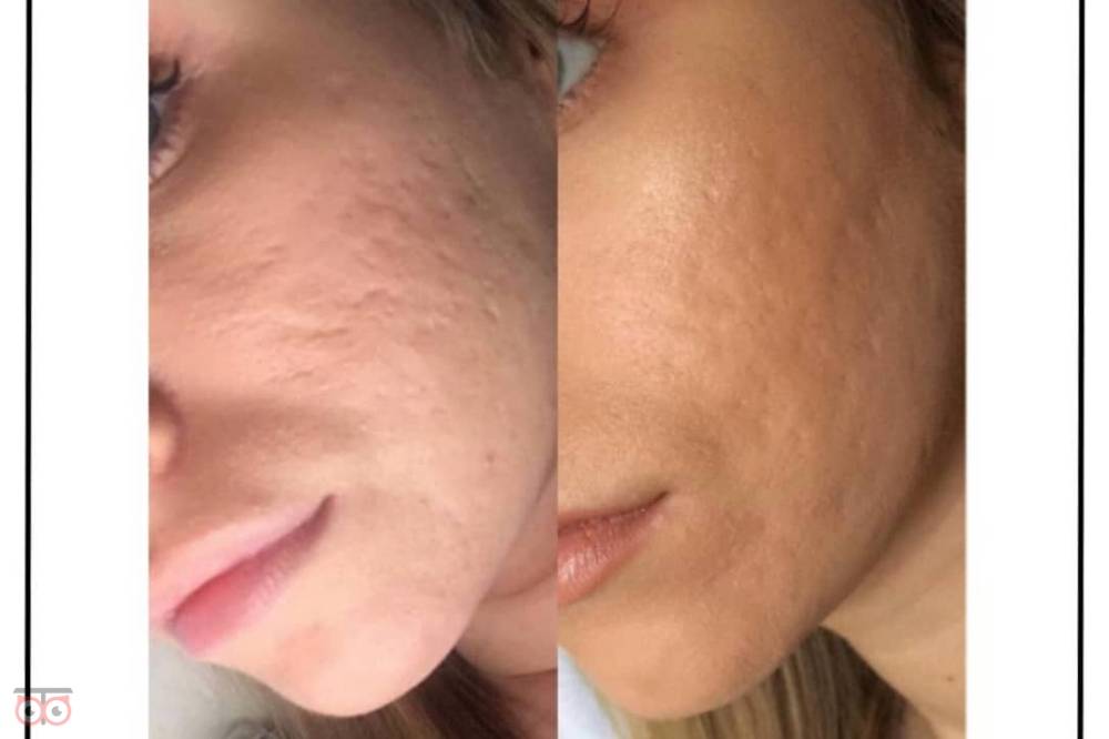 تخفیف ویژه خدمات زیبایی کلینیک دریتا تخفیف ویژه خدمات زیبایی کلینیک دریتا