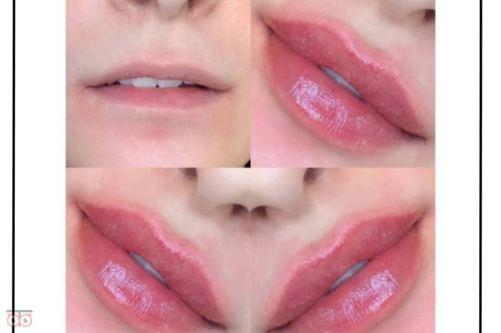 تخفیف ویژه خدمات زیبایی کلینیک دریتا تخفیف ویژه خدمات زیبایی کلینیک دریتا