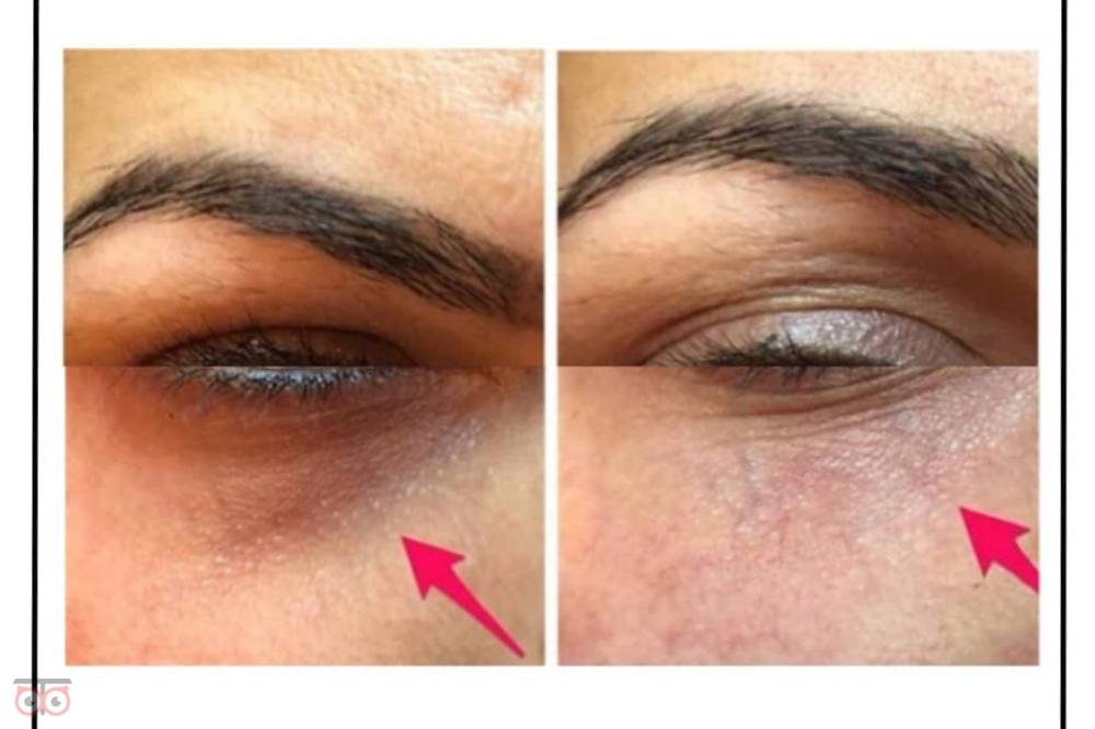 تخفیف ویژه خدمات زیبایی کلینیک دریتا تخفیف ویژه خدمات زیبایی کلینیک دریتا