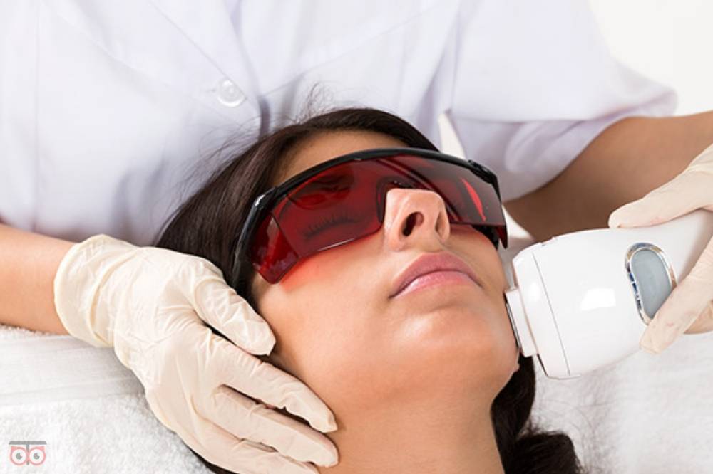 تخفیف لیزر تخفیف لیزر