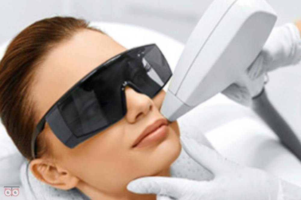 تخفیف لیزر تخفیف لیزر