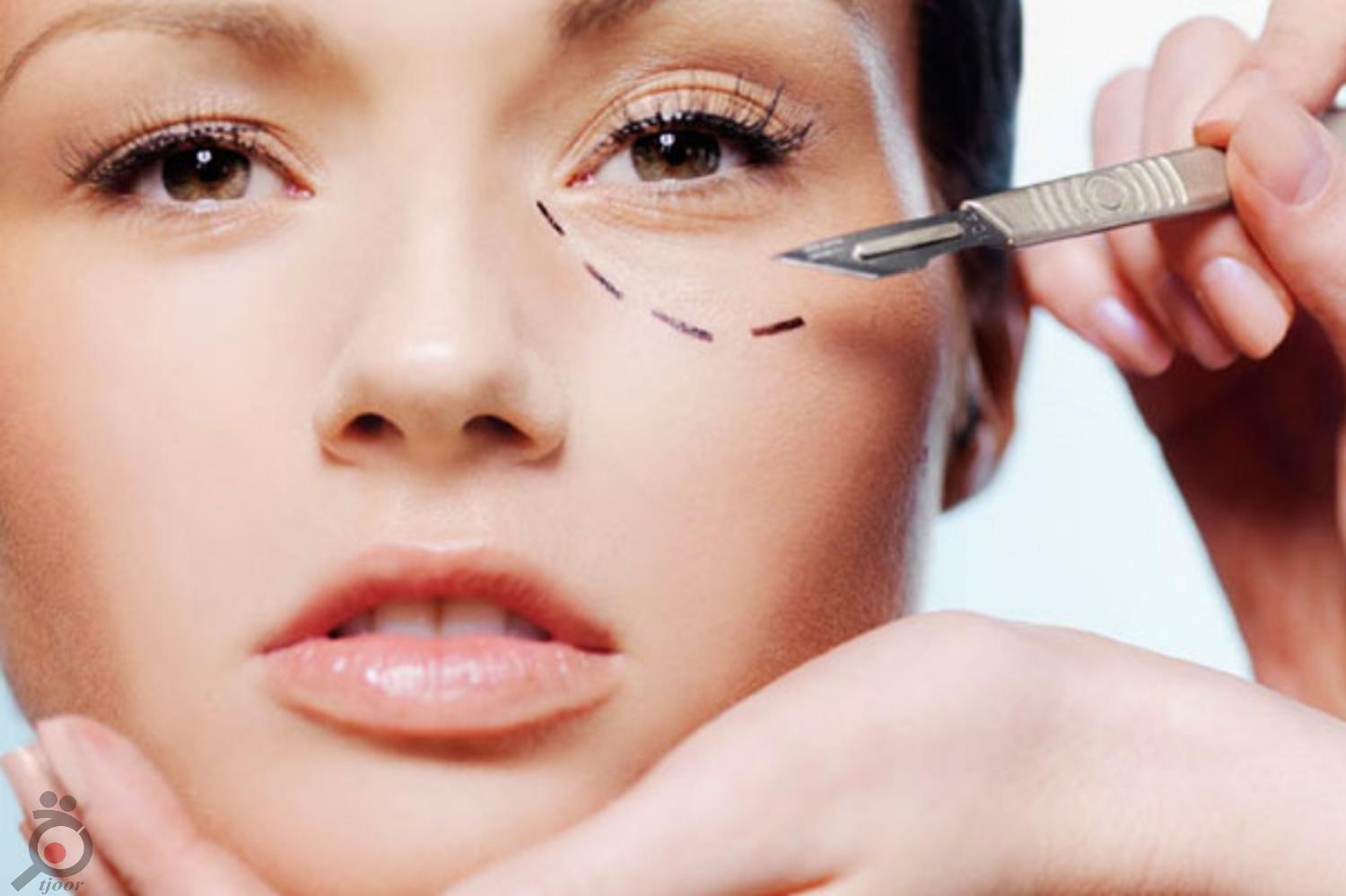 تخفیف خدمات زیبایی کلینیک دکتر فتح آبادی تخفیف خدمات زیبایی کلینیک دکتر فتح آبادی