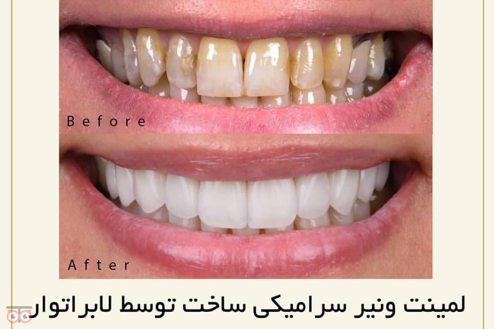 تخفیف ویژه خدمات دندانپزشکی تخفیف ویژه خدمات دندانپزشکی