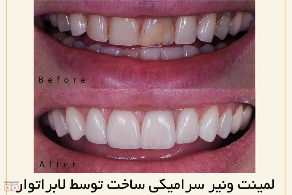 تخفیف ویژه خدمات دندانپزشکی تخفیف ویژه خدمات دندانپزشکی