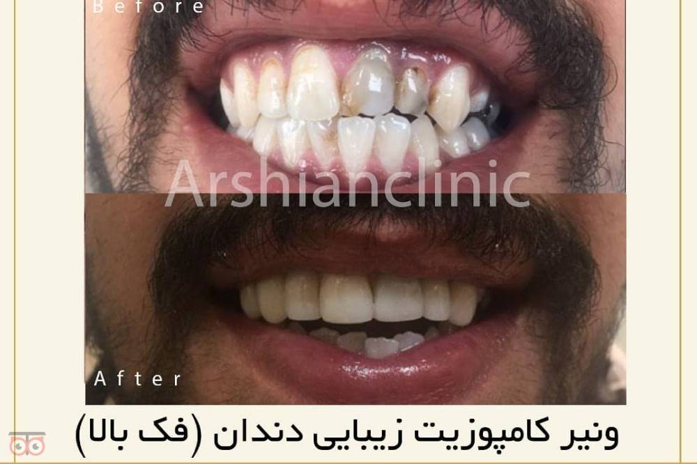 تخفیف ویژه خدمات دندانپزشکی تخفیف ویژه خدمات دندانپزشکی