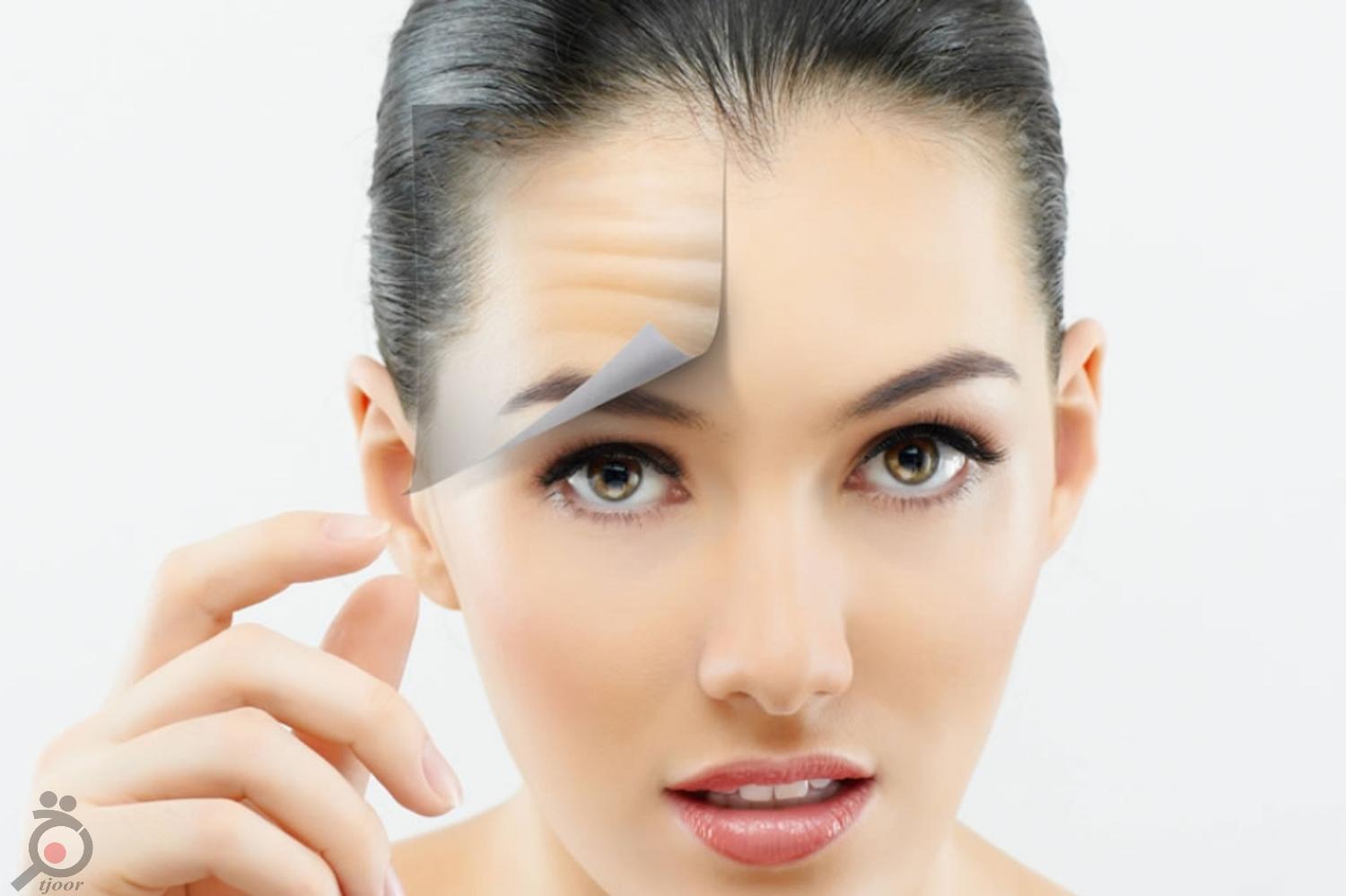 تخفیف درمان لک و جای جوش تخفیف درمان لک و جای جوش