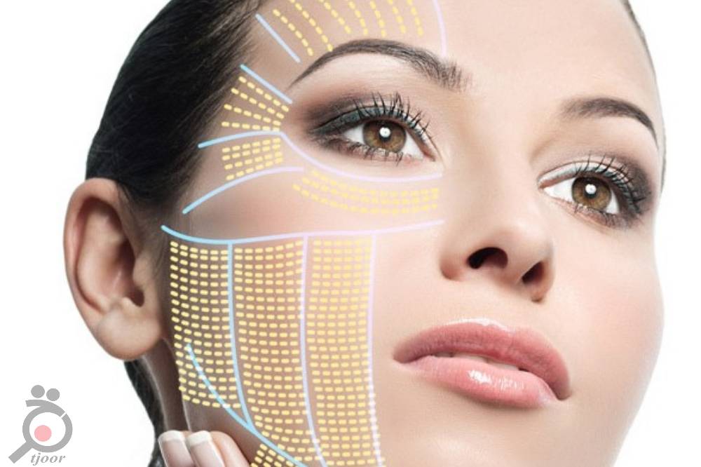 تخفیف ویژه کلینیک دکتر میرزایی تخفیف ویژه کلینیک دکتر میرزایی