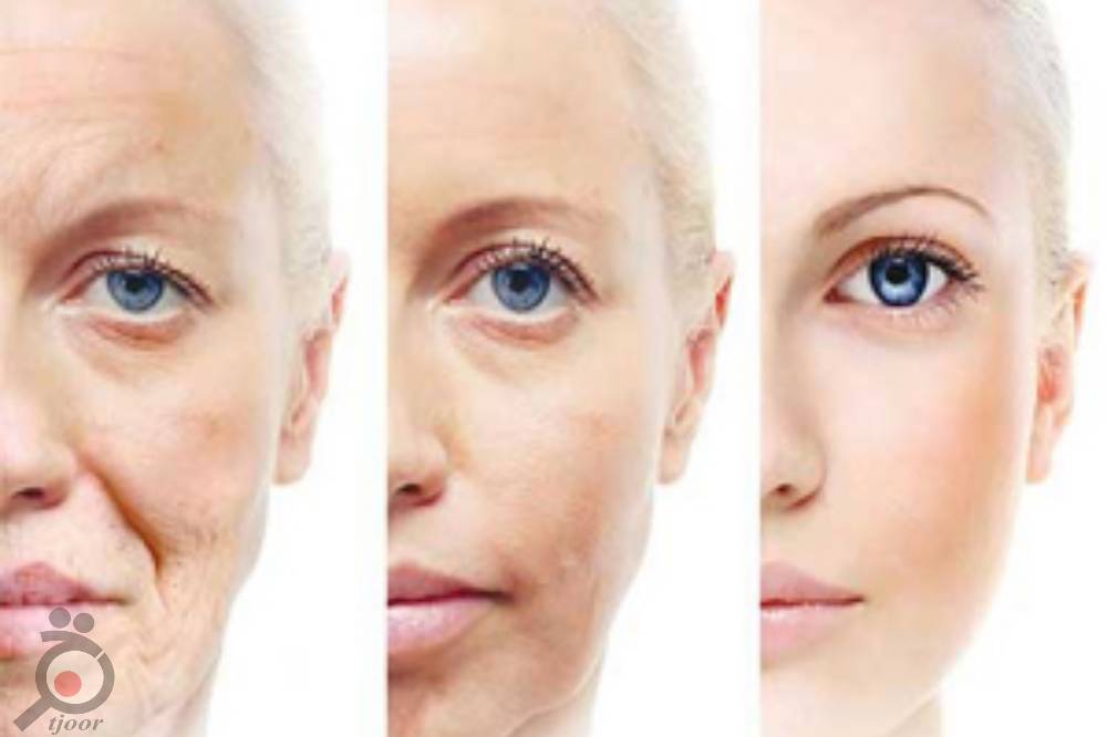 تخفیف ویژه فشیال و پاکسازی صورت تخفیف ویژه فشیال و پاکسازی صورت