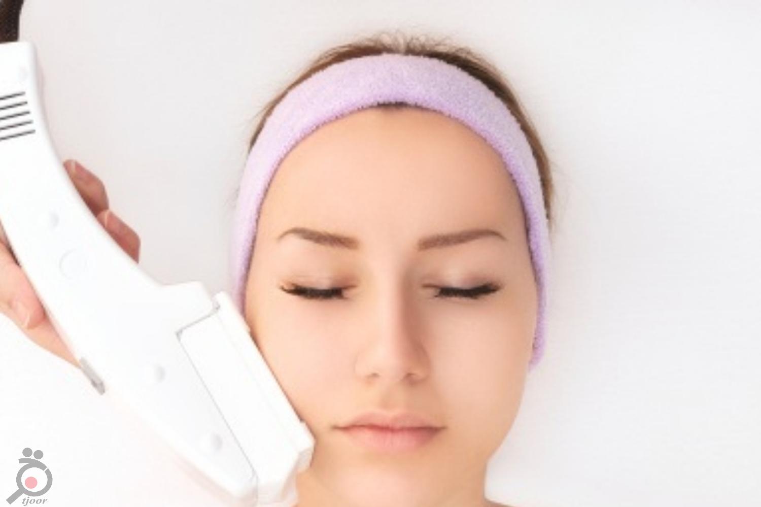 تخفیف ویژه لیزر موهای زائد تخفیف ویژه لیزر موهای زائد