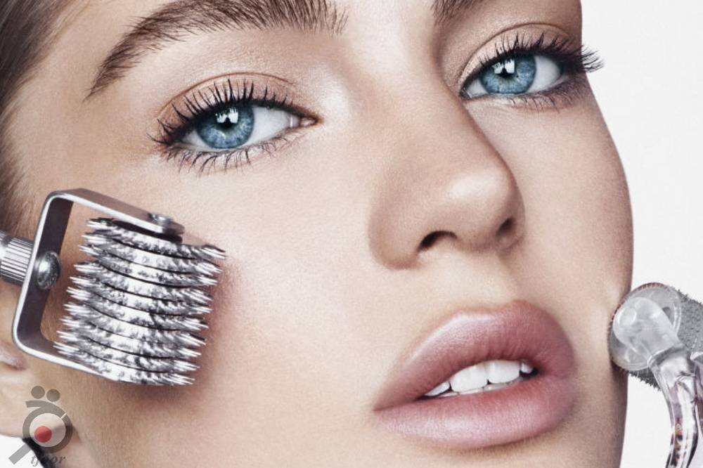 تخفیف میکرونیدلینگ تخفیف میکرونیدلینگ