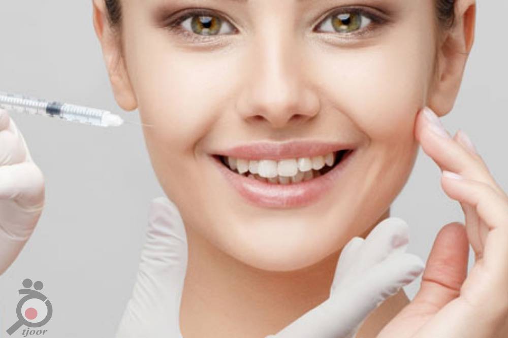 تخفیف میکرونیدلینگ تخفیف میکرونیدلینگ