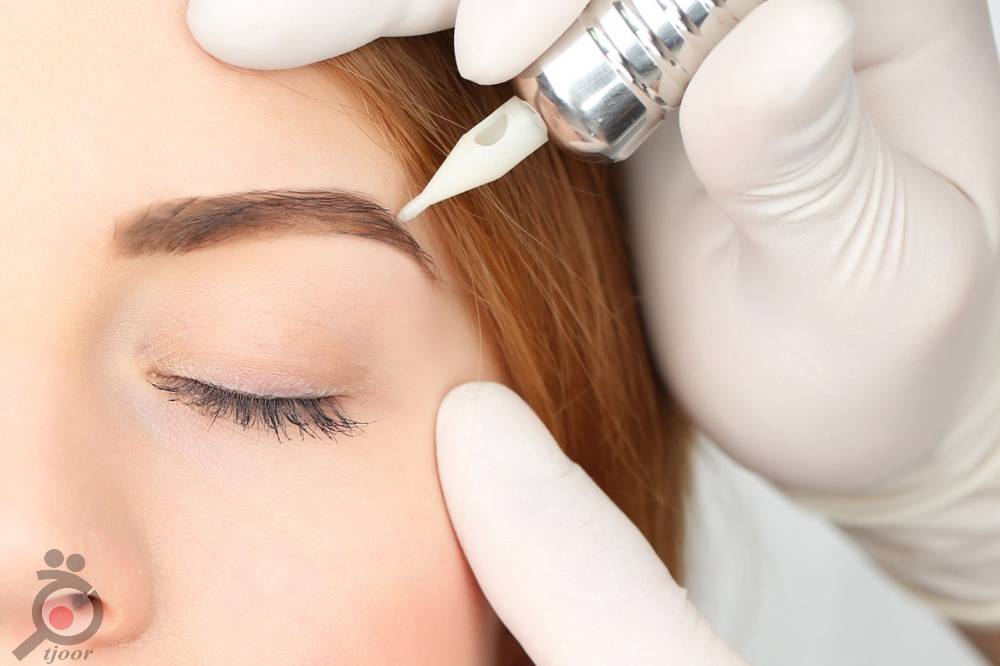 تخفیف تابستانی میکروپیگمنتیشن تخفیف تابستانی میکروپیگمنتیشن