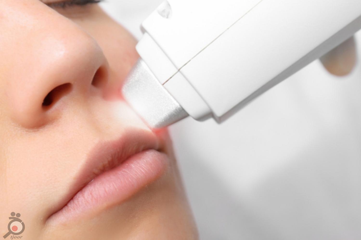 تخفیف جشنواره لیزر موهای زائد تخفیف جشنواره لیزر موهای زائد