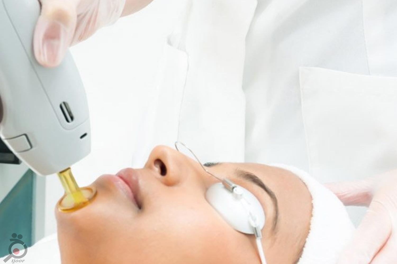 تخفیف جشنواره لیزر موهای زائد تخفیف جشنواره لیزر موهای زائد