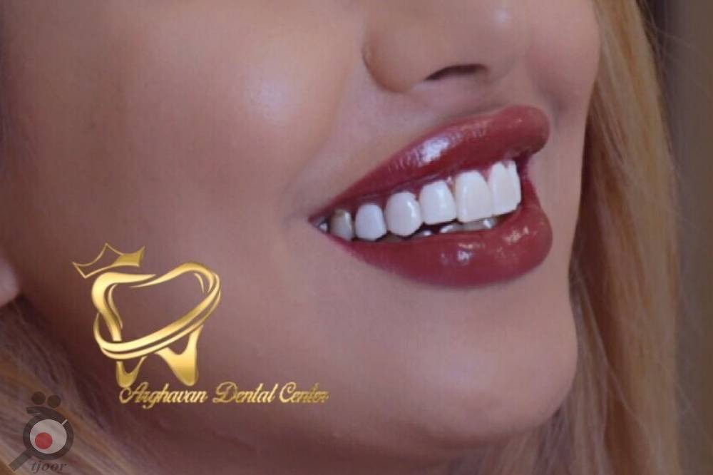 طرح تخفیفات دندانپزشکی از تولد تا تولد به مناسبت دهه کرامت طرح تخفیفات دندانپزشکی از تولد تا تولد به مناسبت دهه کرامت