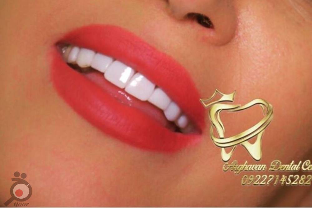 طرح تخفیفات دندانپزشکی از تولد تا تولد به مناسبت دهه کرامت طرح تخفیفات دندانپزشکی از تولد تا تولد به مناسبت دهه کرامت