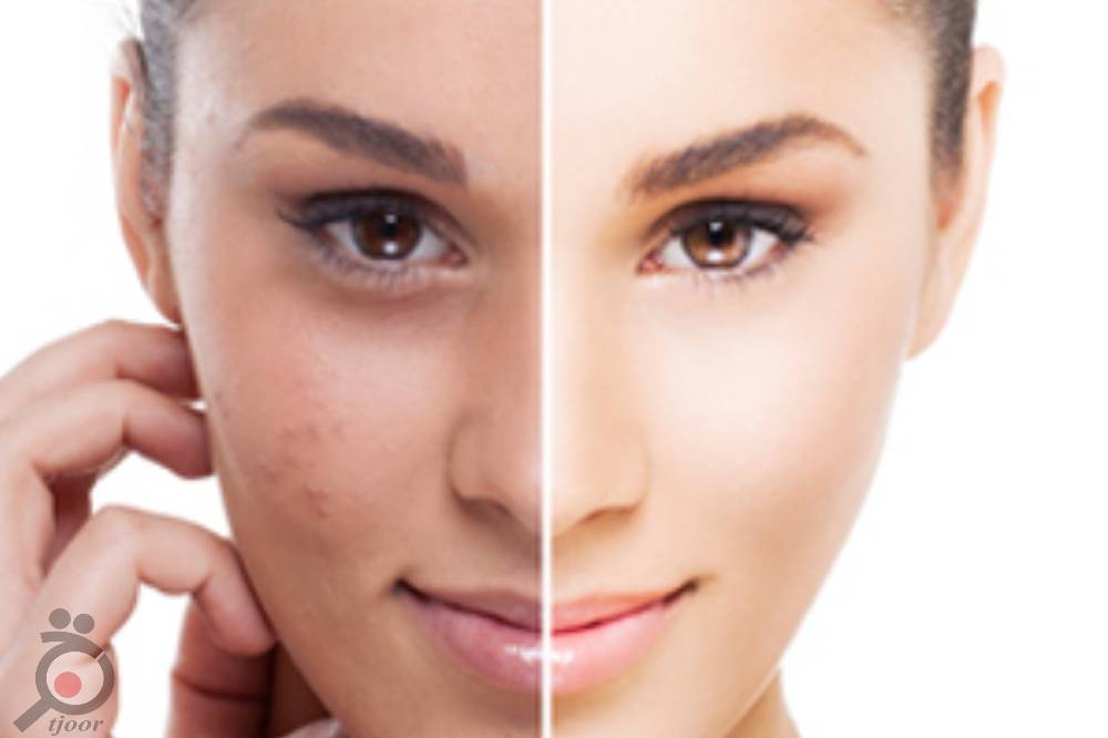 تخفیف خدمات تخصصی زیبایی پوست تخفیف خدمات تخصصی زیبایی پوست