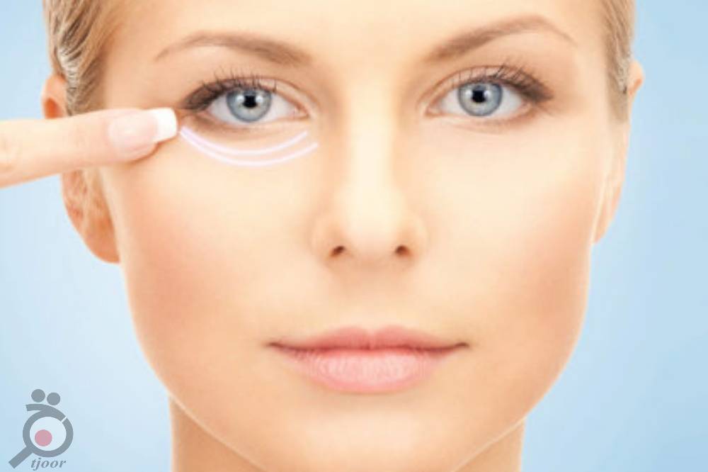 تخفیف ویژه پاکسازی بوسیله اسکوم تراپی تخفیف ویژه پاکسازی بوسیله اسکوم تراپی