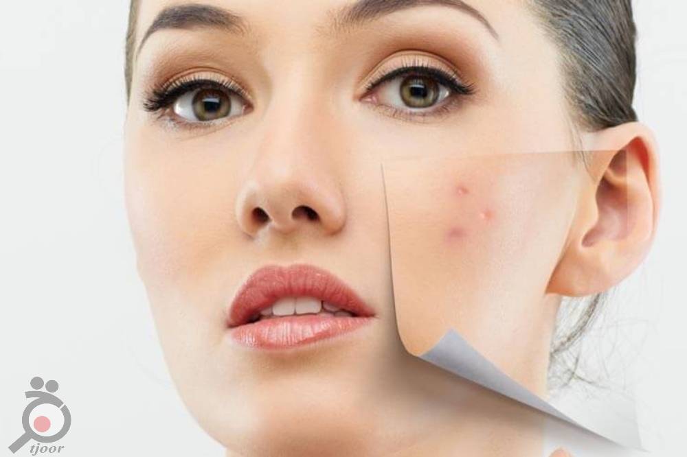 تخفیف خدمات پاکسازی صورت برای بانوان تخفیف خدمات پاکسازی صورت برای بانوان
