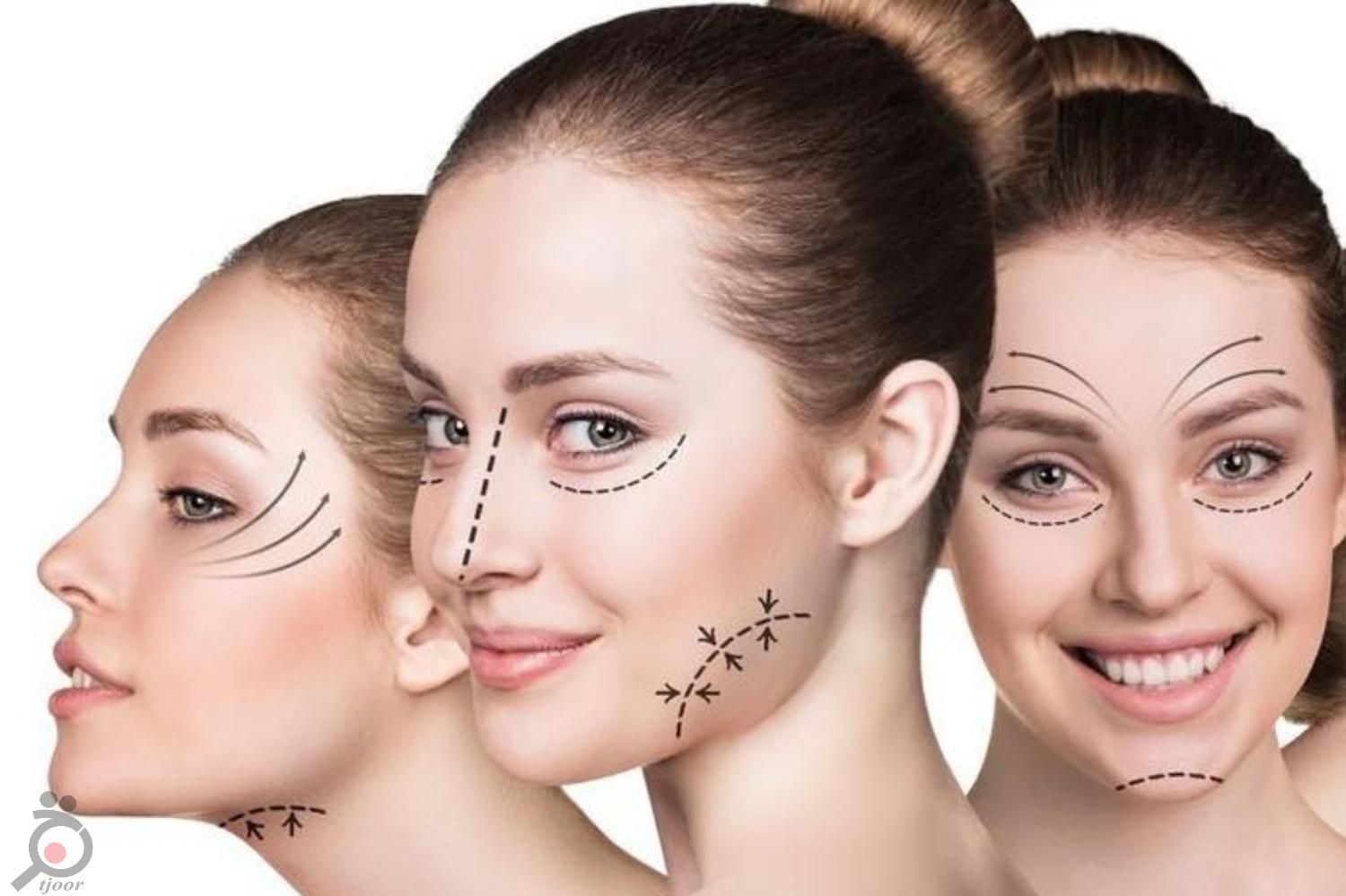 تخفیف ویژه رفع چروک دور چشم و جوانسازی دور چشم تخفیف ویژه رفع چروک دور چشم و جوانسازی دور چشم