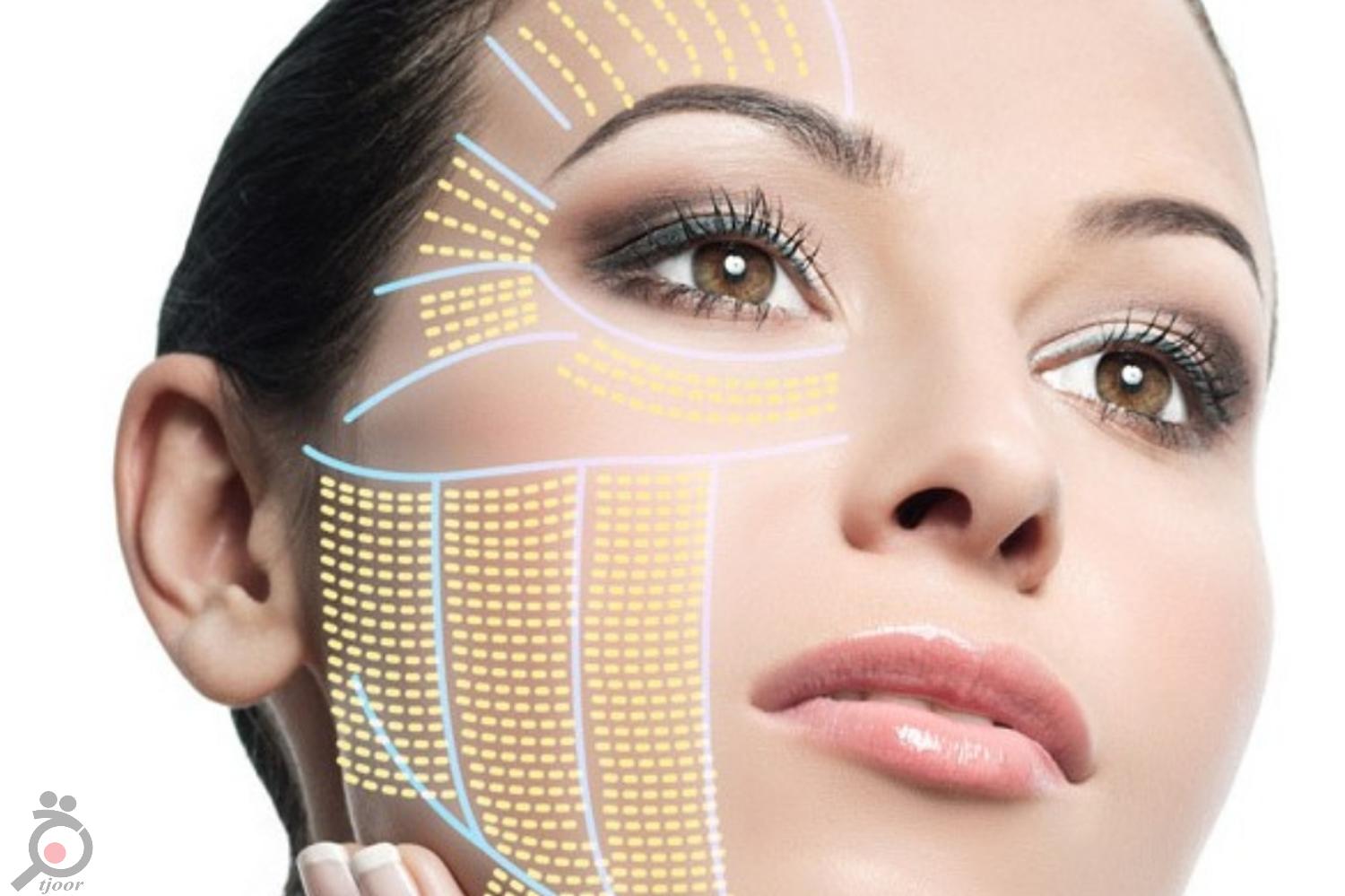 تخفیف ویژه رفع چروک دور چشم و جوانسازی دور چشم تخفیف ویژه رفع چروک دور چشم و جوانسازی دور چشم