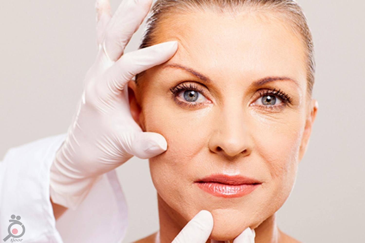 تخفیف ویژه رفع افتادگی پلک بدون عمل جراحی تخفیف ویژه رفع افتادگی پلک بدون عمل جراحی