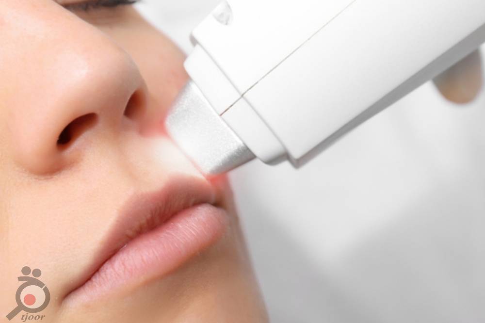 تخفیف ویژه خدمات لیزر موهای زائد تخفیف ویژه خدمات لیزر موهای زائد