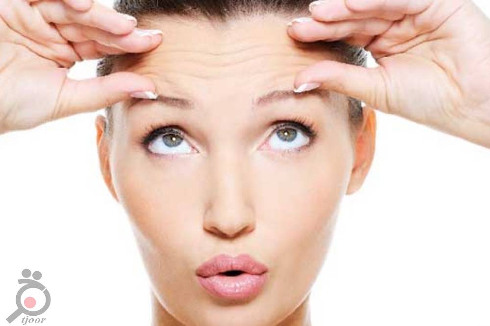 تخفیف ویژه عمل لیفت صورت تخفیف ویژه عمل لیفت صورت