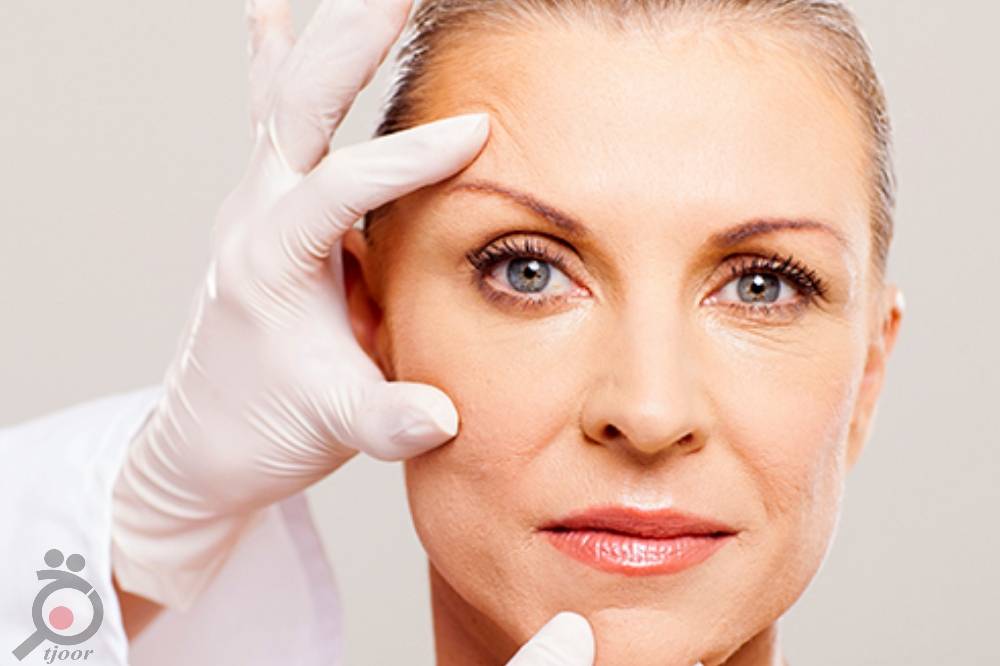 تخفیف ویژه عمل لیفت صورت تخفیف ویژه عمل لیفت صورت