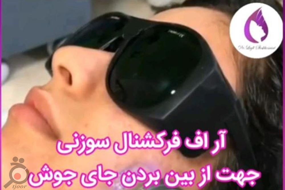 تخفیف کلینیک دکتر شاه حسینی رو از دست ندید تخفیف کلینیک دکتر شاه حسینی رو از دست ندید