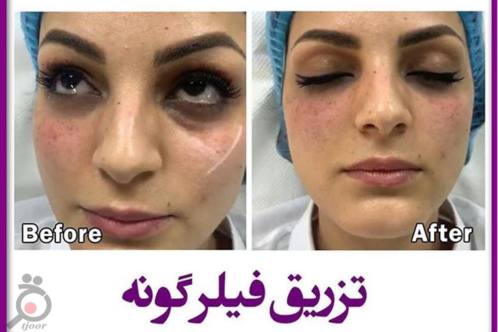 تخفیف کلینیک دکتر شاه حسینی رو از دست ندید تخفیف کلینیک دکتر شاه حسینی رو از دست ندید